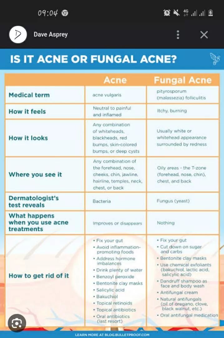 Make amazing websites